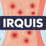 Peau irritée avec irquis et soins